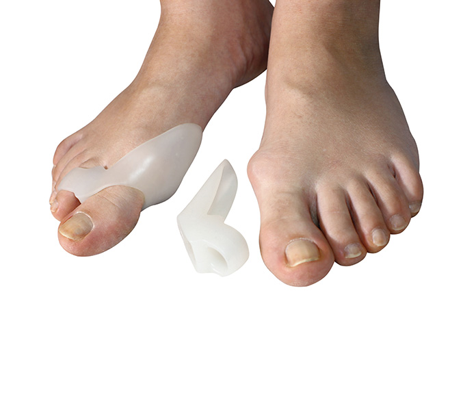 custom insoles for Bunions and Hammertoes Treatment in Mathura 
