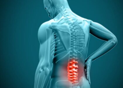 Spine Surgery in Mathura