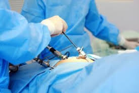 laparoscopy surgery for infertility in mathura