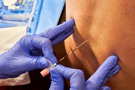 steroids for joint pain relief in dharwad