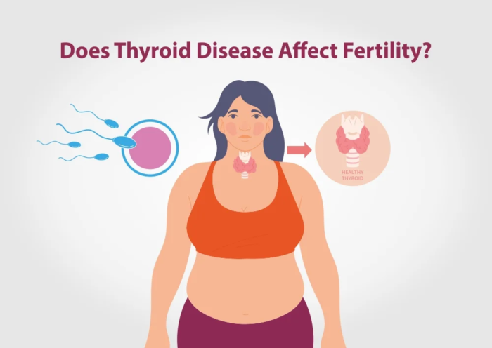 Thyroid & Infertility Treatment in Mathura
