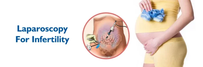 laparoscopy for infertility management in mathura 
