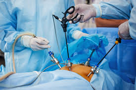 Fibroid Removal Treatment in Mathura