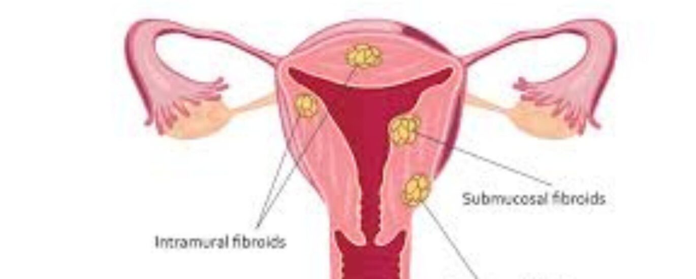 Untitled design (25)