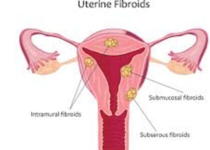 Untitled design (25)