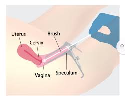 pap smear test in Mathura 
