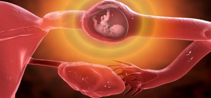 Ectopic Pregnancy Treatment in Mathura