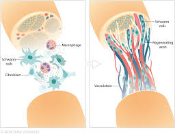 Peripheral nerve repair in Mathura 