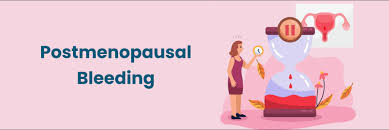 endometrial polyps treatment in Mathura
