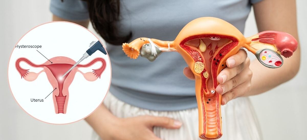 Hysteroscopy