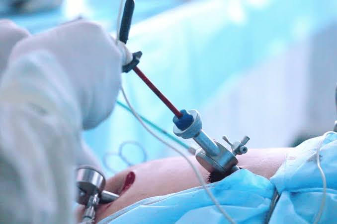 Hysteroscopy in Mathura 
