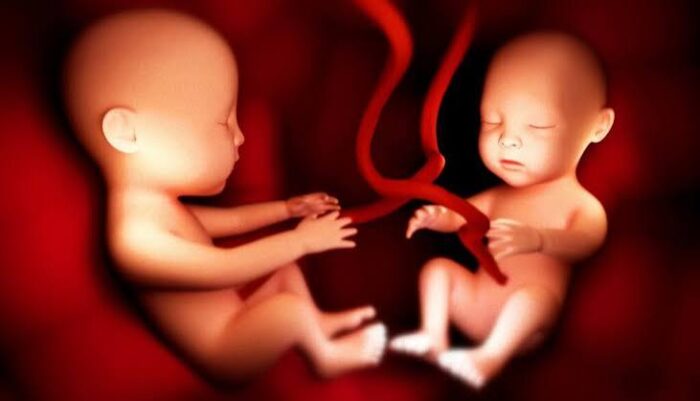 Pre-eclampsia treatment in Mathura