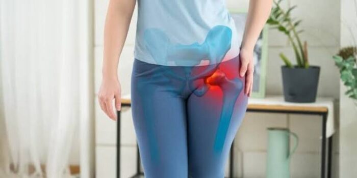 hip arthritis treatment in Mathura 
